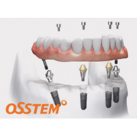 Имплантационная система Osstem